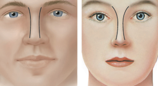 Frente Nasal Hombre vs. Mujer
